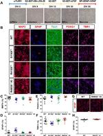 Desmin Antibody in Immunohistochemistry (IHC)