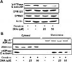 V-ATPase E1 Antibody in Western Blot (WB)