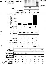 V-ATPase E1 Antibody in Western Blot (WB)