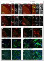 CD11b Antibody in Immunohistochemistry (IHC)