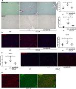 CD31 (PECAM-1) Antibody in Immunohistochemistry (IHC)