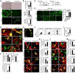 CD140a (PDGFRA) Antibody in Immunohistochemistry (IHC)