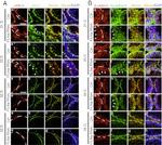 beta Catenin Antibody in Immunohistochemistry (IHC)