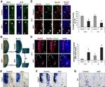 HDAC1 Antibody in Immunohistochemistry (IHC)