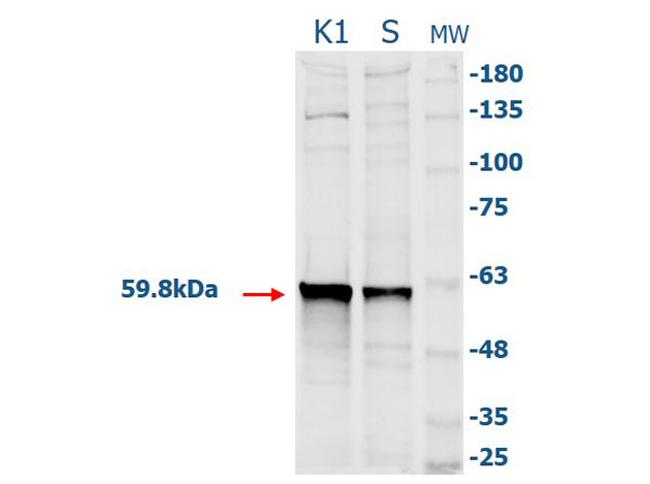 Catalase Antibody in Western Blot (WB)