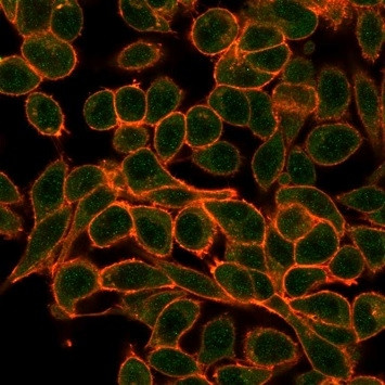 MEF2B (Transcriptional Activator) Antibody in Immunocytochemistry (ICC/IF)