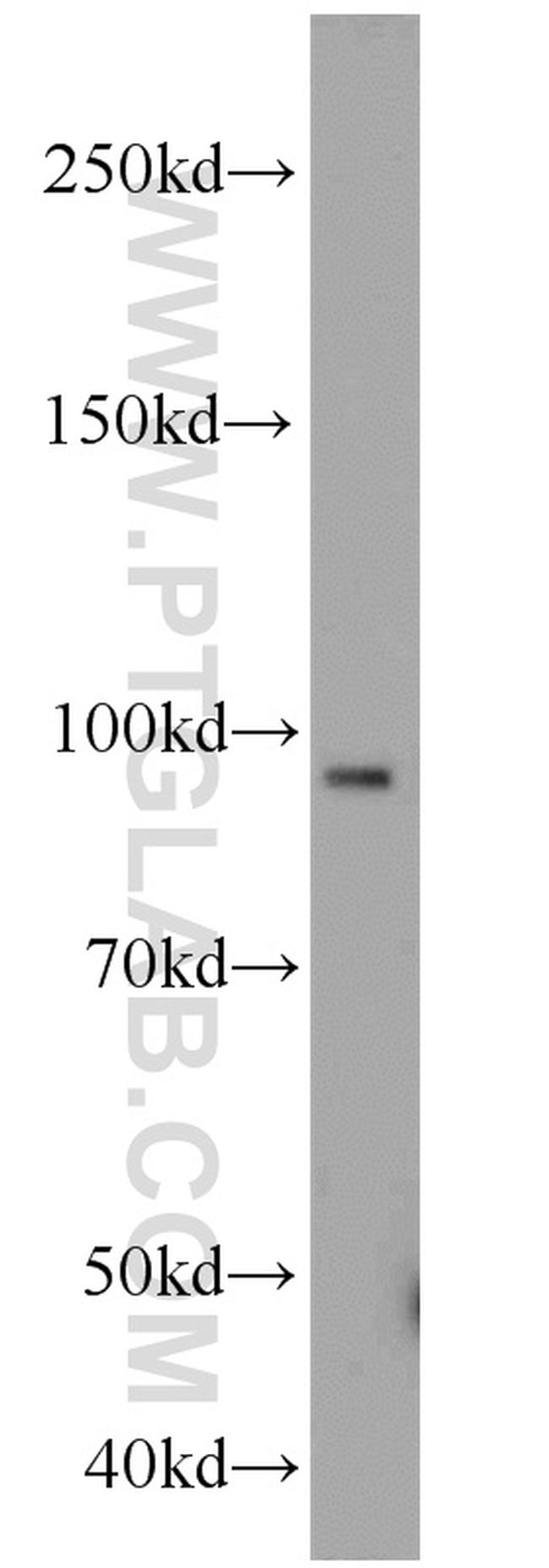 Importin beta Antibody in Western Blot (WB)