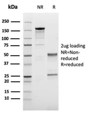 Cadherin 17/LI Cadherin (Liver-Intestine Marker) Antibody in SDS-PAGE (SDS-PAGE)