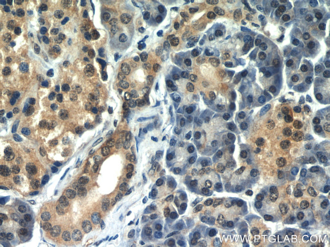 Ubiquitin Antibody in Immunohistochemistry (Paraffin) (IHC (P))