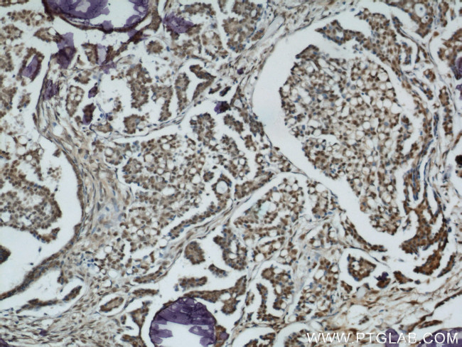 Ubiquitin Antibody in Immunohistochemistry (Paraffin) (IHC (P))