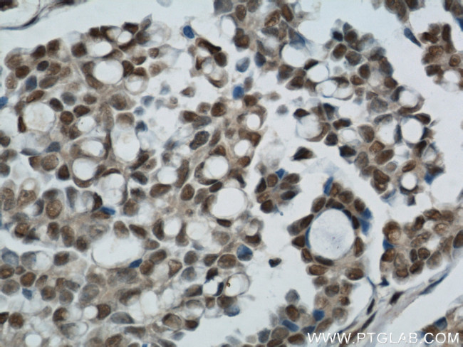 Ubiquitin Antibody in Immunohistochemistry (Paraffin) (IHC (P))