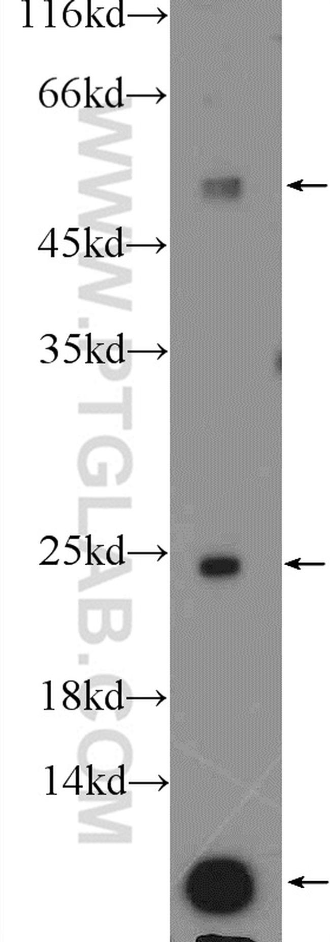 Ubiquitin Antibody in Western Blot (WB)