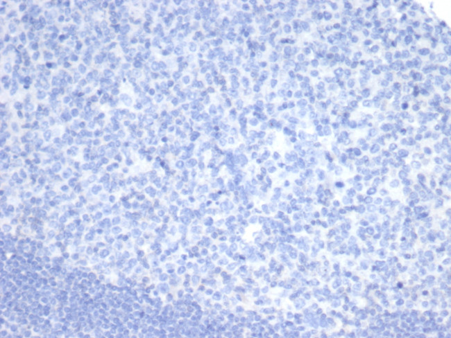 OLIG2 (Marker of Glial Brain Tumors) Antibody in Immunohistochemistry (Paraffin) (IHC (P))