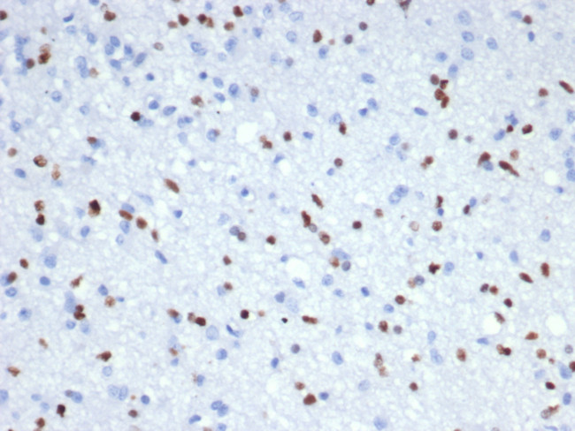 OLIG2 (Marker of Glial Brain Tumors) Antibody in Immunohistochemistry (Paraffin) (IHC (P))