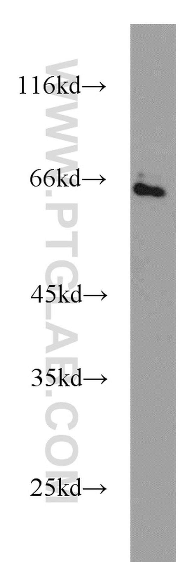 SMAD4 Antibody in Western Blot (WB)