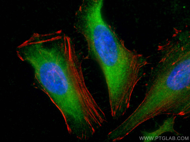 IkB alpha Antibody in Immunocytochemistry (ICC/IF)