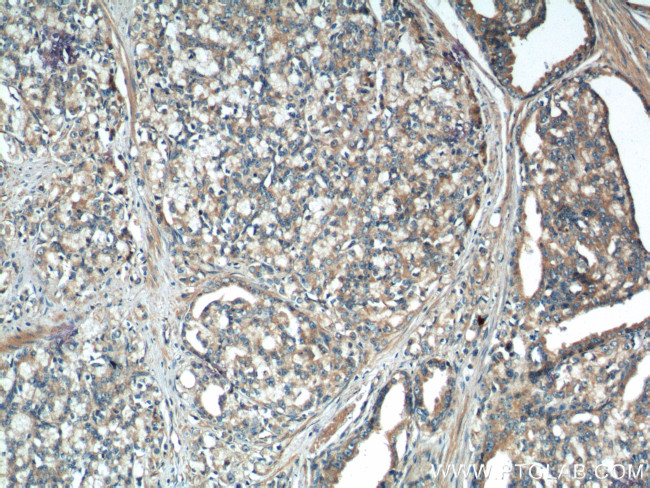 IkB alpha Antibody in Immunohistochemistry (Paraffin) (IHC (P))