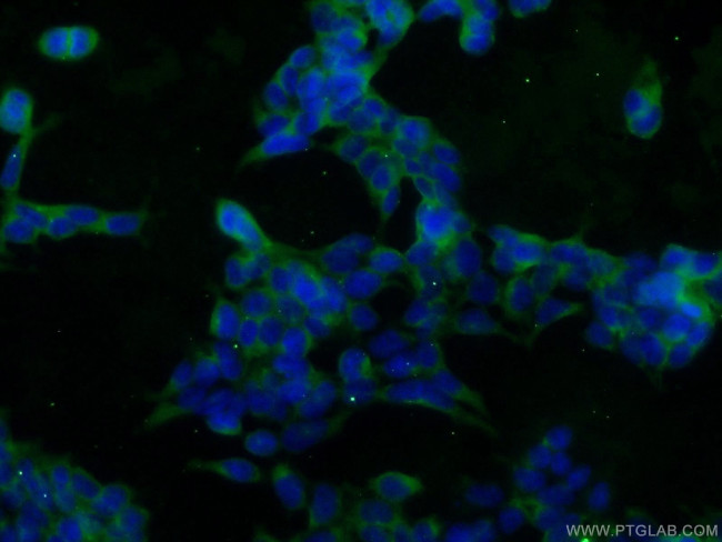 SOD1 Antibody in Immunocytochemistry (ICC/IF)