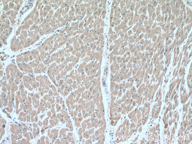 SOD1 Antibody in Immunohistochemistry (Paraffin) (IHC (P))