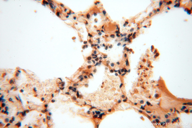 SOD1 Antibody in Immunohistochemistry (Paraffin) (IHC (P))