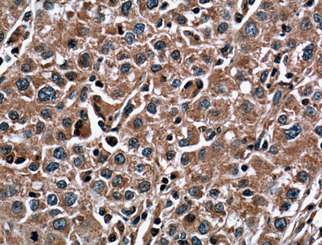 SOD1 Antibody in Immunohistochemistry (Paraffin) (IHC (P))