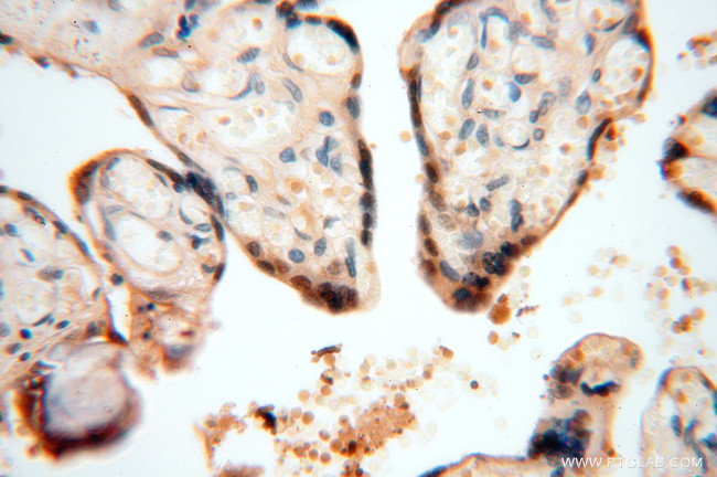 SOD1 Antibody in Immunohistochemistry (Paraffin) (IHC (P))