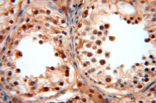 SOD1 Antibody in Immunohistochemistry (Paraffin) (IHC (P))