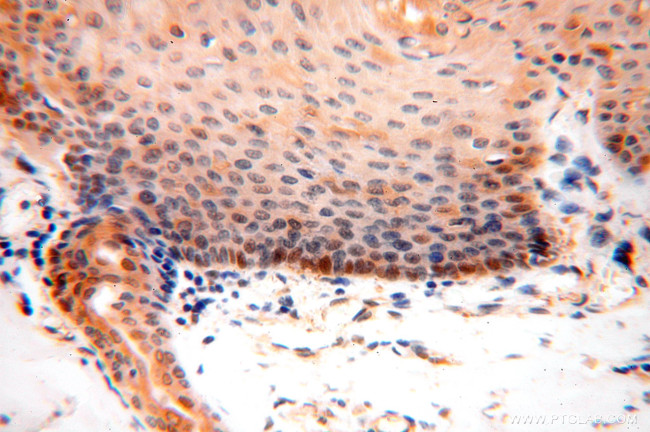 SOD1 Antibody in Immunohistochemistry (Paraffin) (IHC (P))