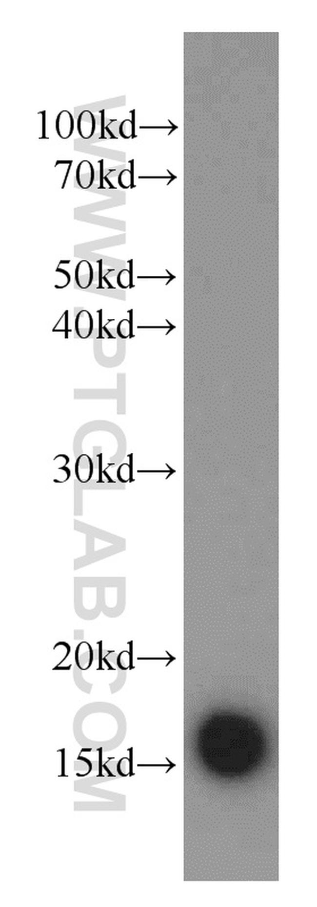 SOD1 Antibody in Western Blot (WB)