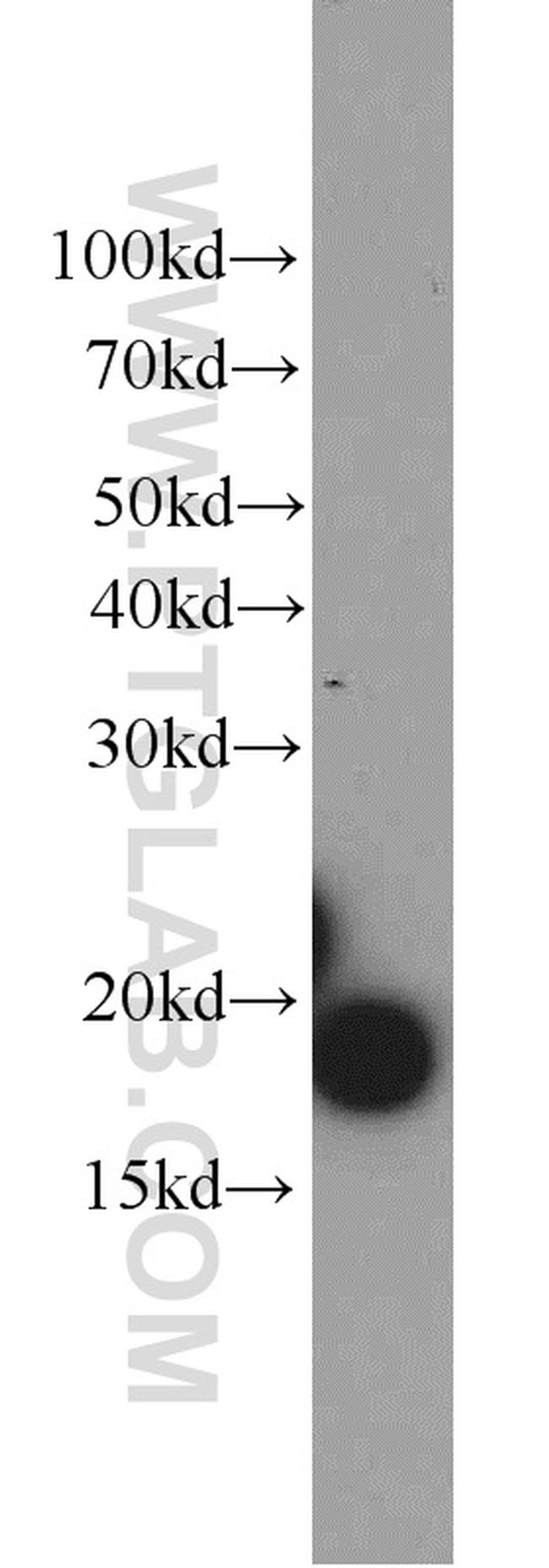 SOD1 Antibody in Western Blot (WB)