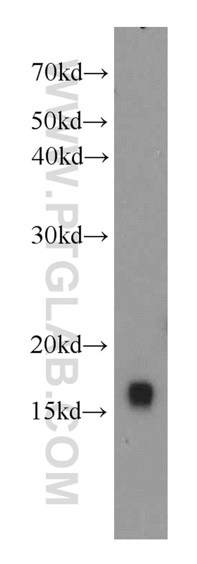 SOD1 Antibody in Western Blot (WB)