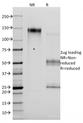 p14ARF Antibody in SDS-PAGE (SDS-PAGE)