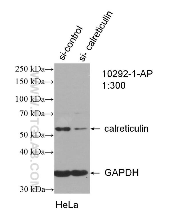 calreticulin Antibody in Western Blot (WB)