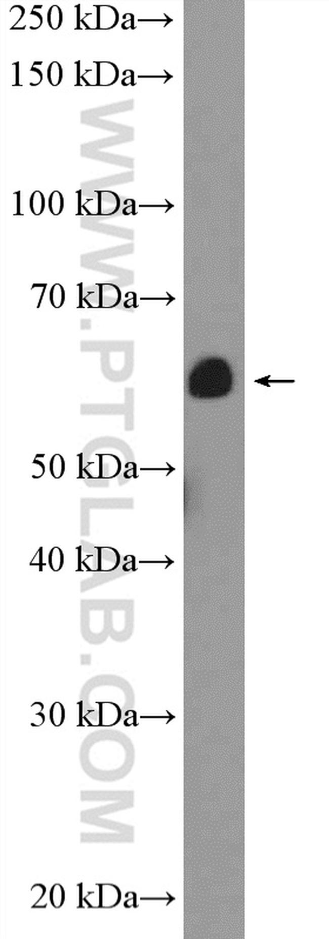 calreticulin Antibody in Western Blot (WB)