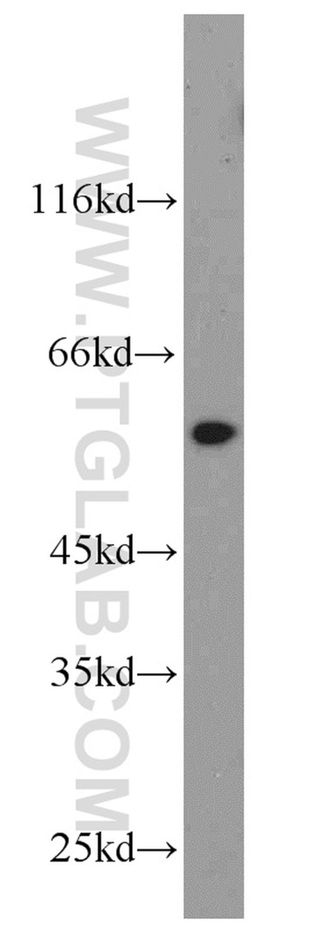 calreticulin Antibody in Western Blot (WB)