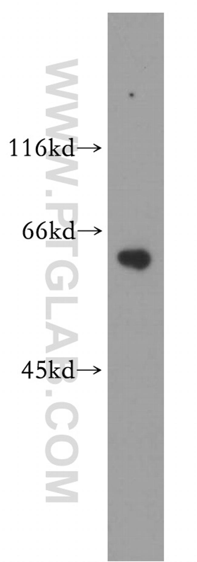 calreticulin Antibody in Western Blot (WB)