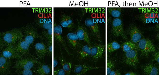 TRIM32 Antibody in Immunocytochemistry (ICC/IF)