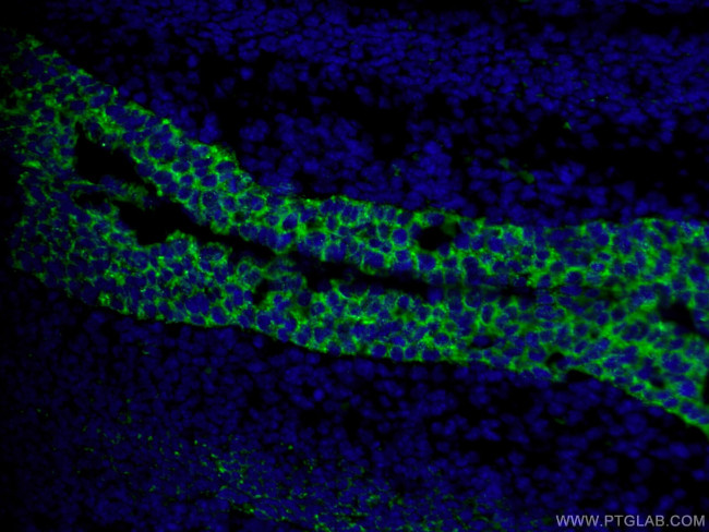 TRIM32 Antibody in Immunohistochemistry (PFA fixed) (IHC (PFA))