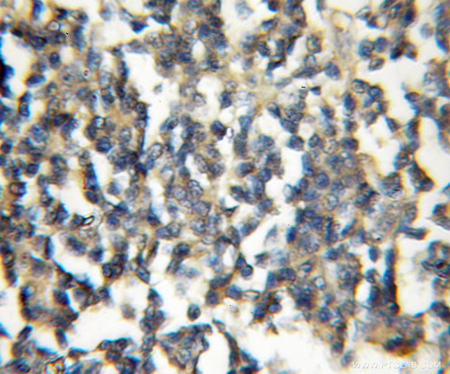 TRIM32 Antibody in Immunohistochemistry (Paraffin) (IHC (P))