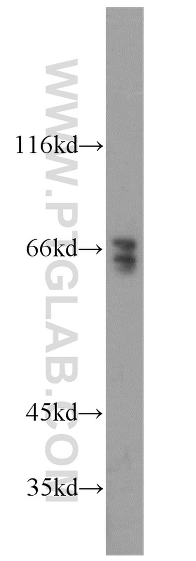 TRIM32 Antibody in Western Blot (WB)