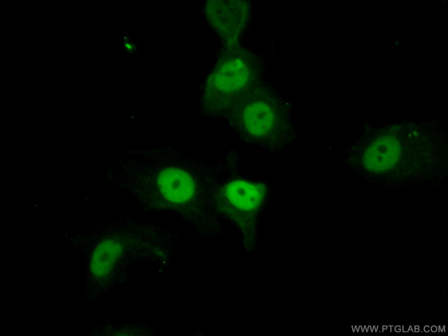 P21 Antibody in Immunocytochemistry (ICC/IF)