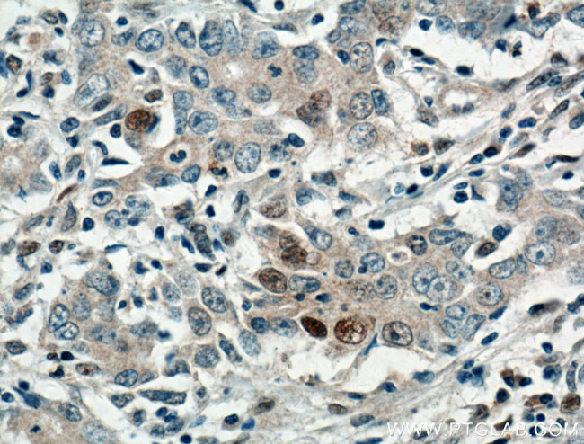 P21 Antibody in Immunohistochemistry (Paraffin) (IHC (P))