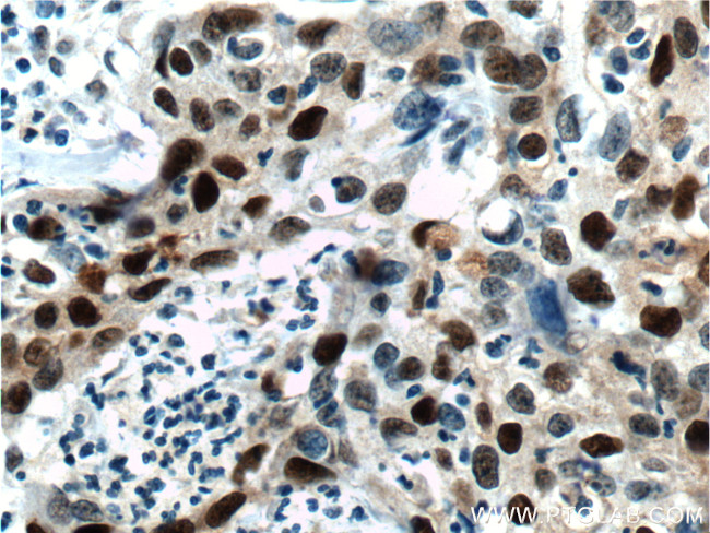 P21 Antibody in Immunohistochemistry (Paraffin) (IHC (P))