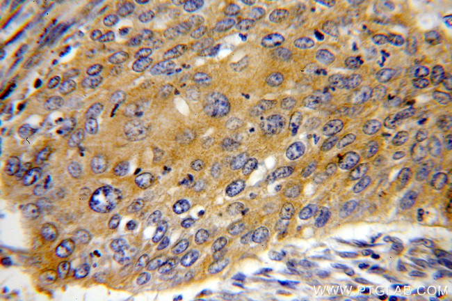 MMP1 Antibody in Immunohistochemistry (Paraffin) (IHC (P))