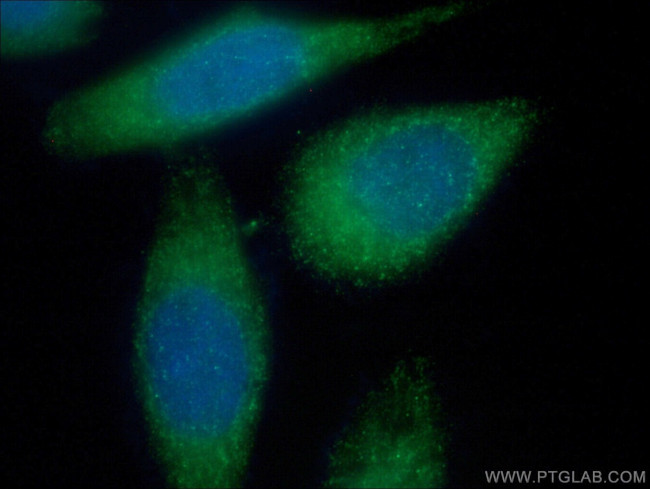 MMP2 Antibody in Immunocytochemistry (ICC/IF)