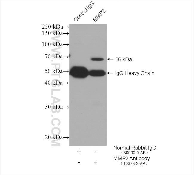 MMP2 Antibody in Immunoprecipitation (IP)