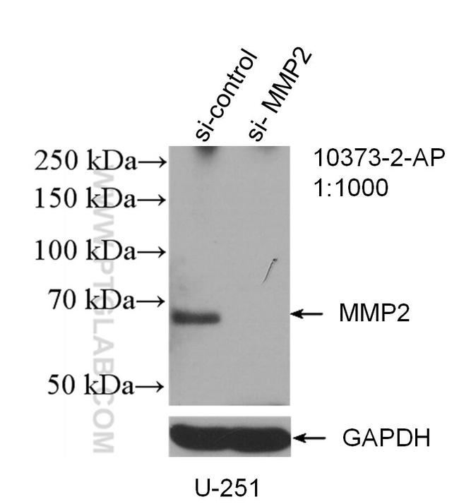 MMP2 Antibody in Western Blot (WB)