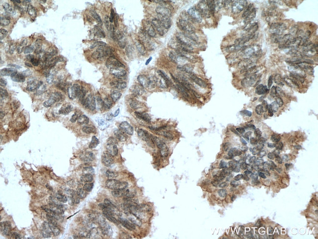 BAP1 Antibody in Immunohistochemistry (Paraffin) (IHC (P))