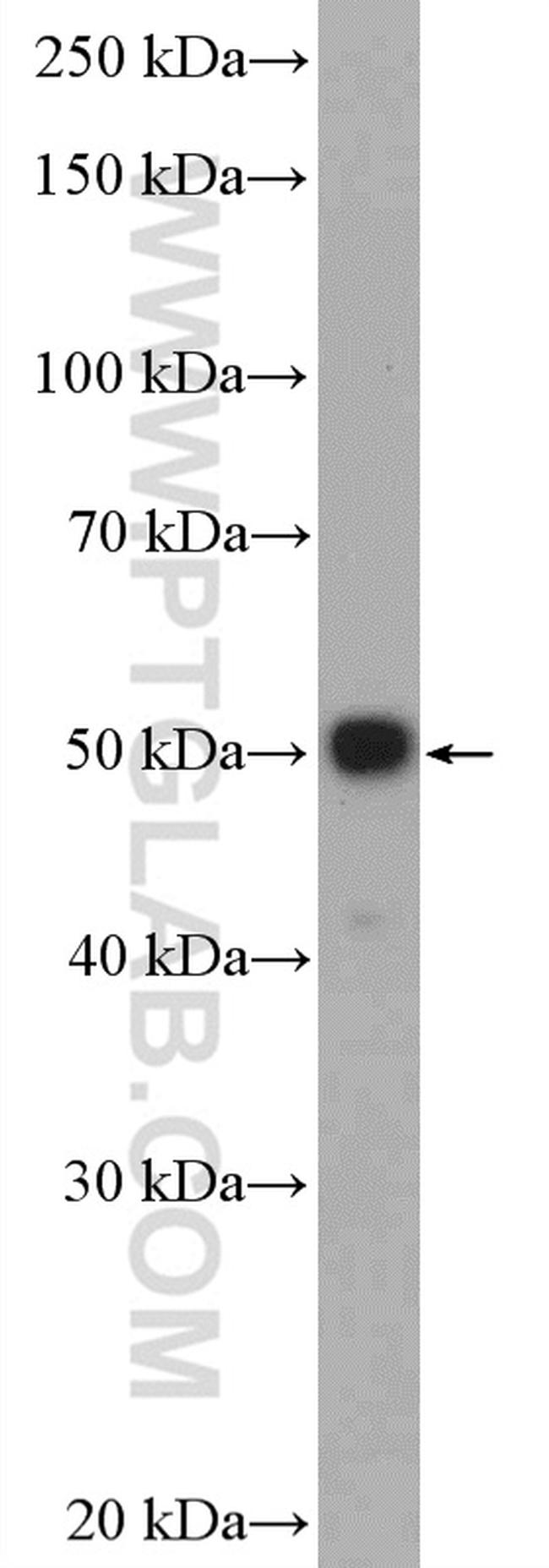 P53 Antibody in Western Blot (WB)