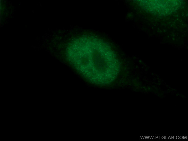 P53 Antibody in Immunocytochemistry (ICC/IF)